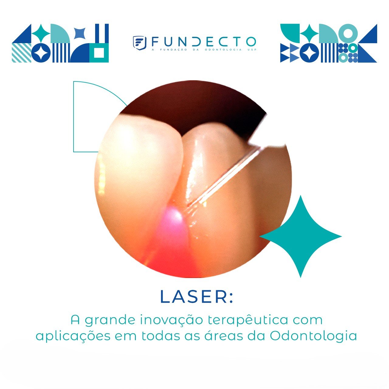 Laser em Odontologia