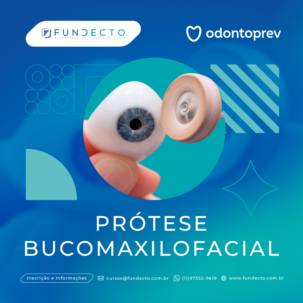 Reabilitação Protética Bucomaxilofacial em Perdas Maxilares