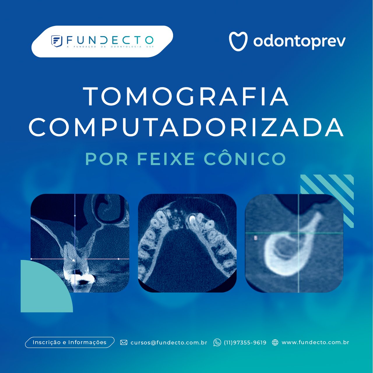 A utilização da Tomografia na Odontologia